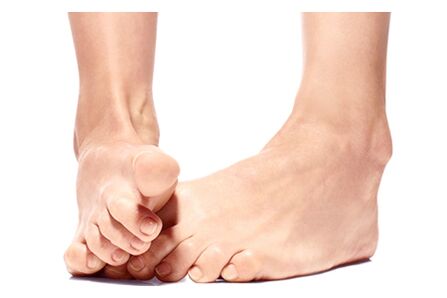 Foot Trooper - natural remedy against foot and nail fungus